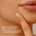 Acniben corrector 3 dermapro dermafarmacia
