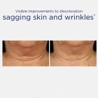 NeoStrata Triple Firming Neck Cream MicroDiPeptide229 dermapro dermafarmacia