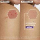 Epitheliale A.H Ultra Repair tienda en linea compra dermafarmacia dermapro